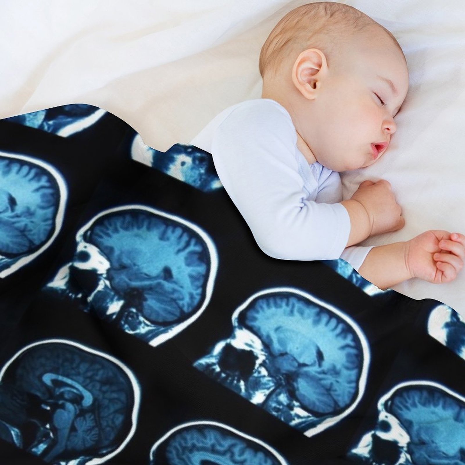 Brain MRI x-ray deken Zware ke - 3D Printing X Ray recensie en prijs